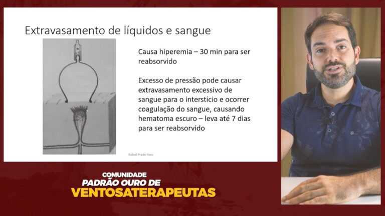 Guia Completo: Curso de Ventosa Terapia