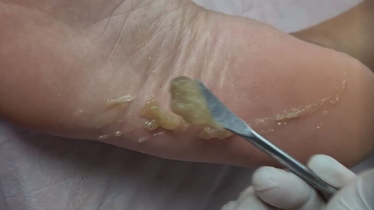 Curso de Spa para os Pés: Tudo o Que Você Precisa Saber